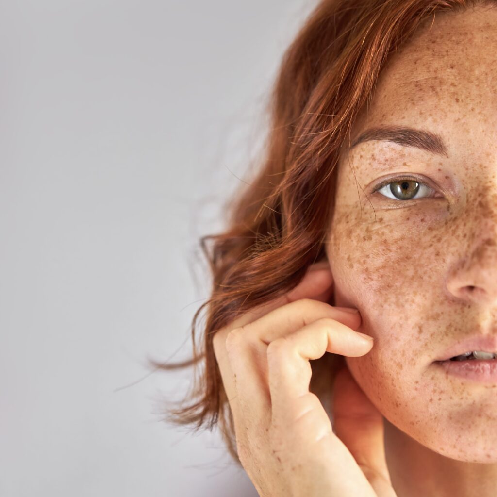 Clinique Confidence : rajeunissement du visage