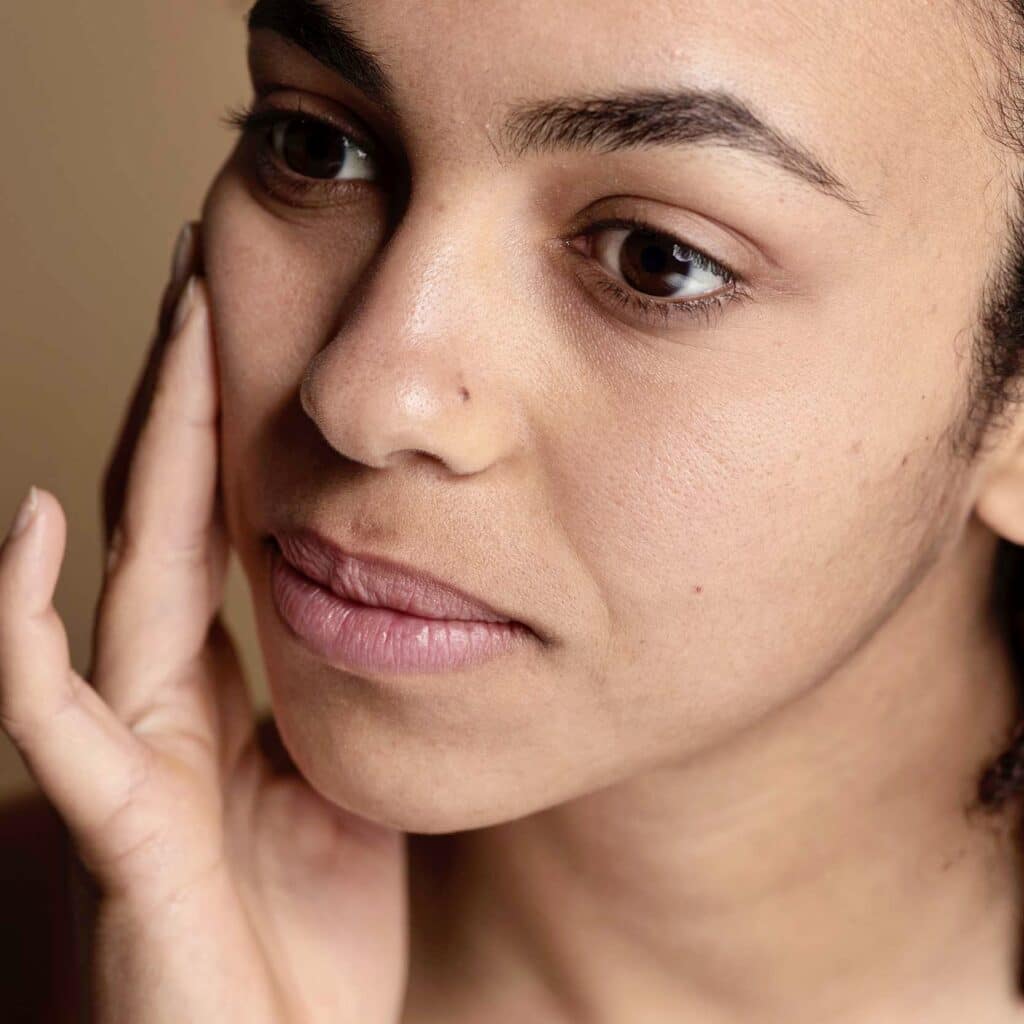 Acne-traitement-cicatrice-confidence-clinique-esthetique-marcq-en-baroeul-lille-6 2