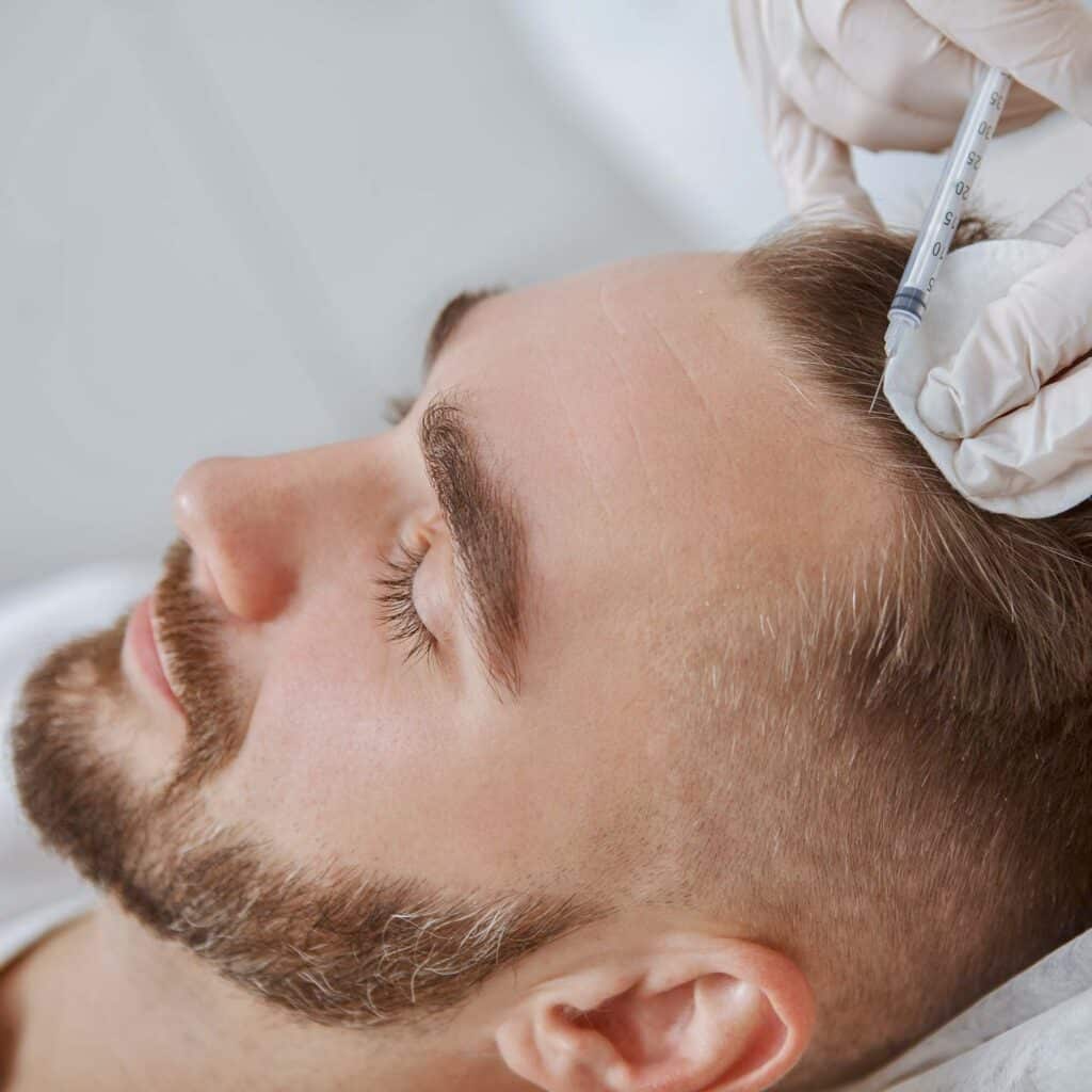calvitie-alopecie-confidence-clinique-esthetique-lille-marcq-en-baroeul-6
