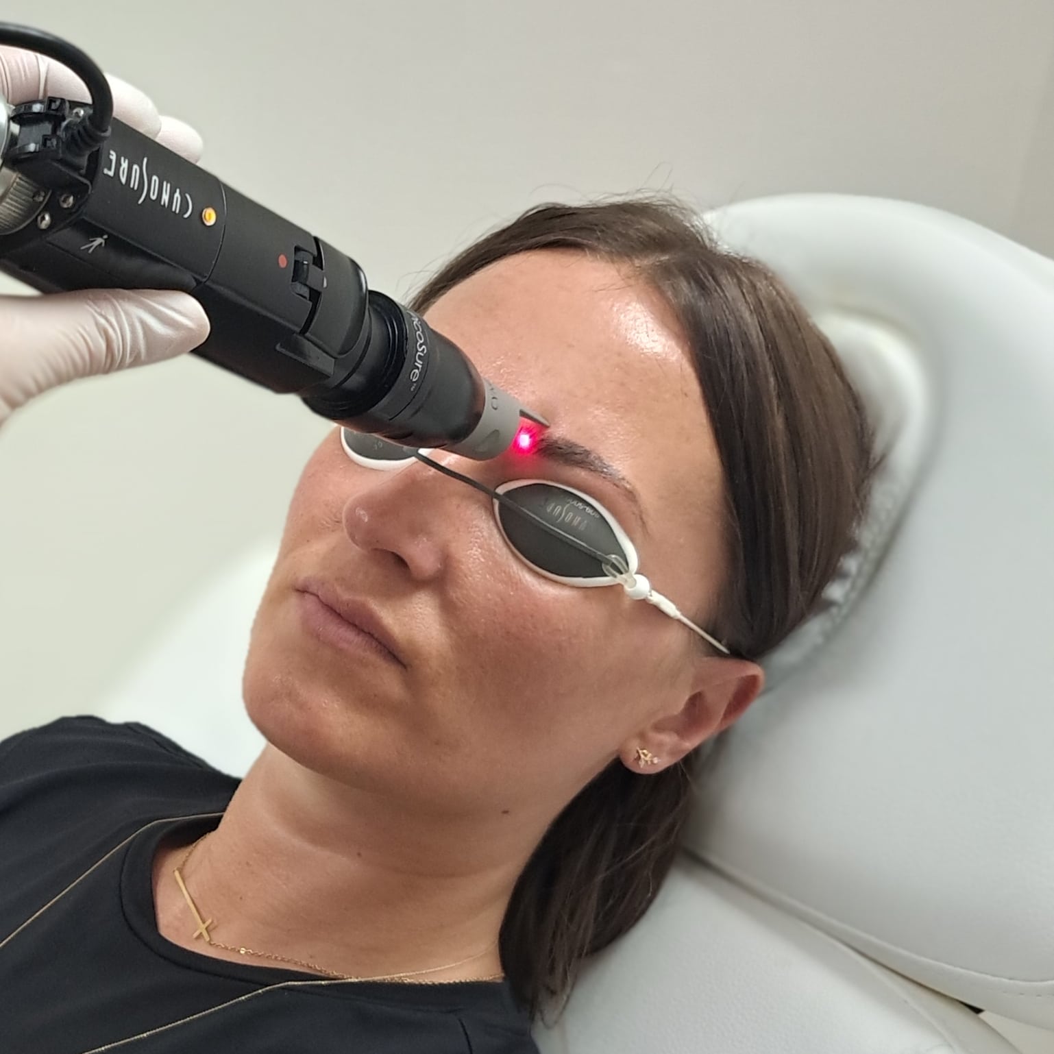 Détatouage laser picosure à Lille - Clinique Confidence