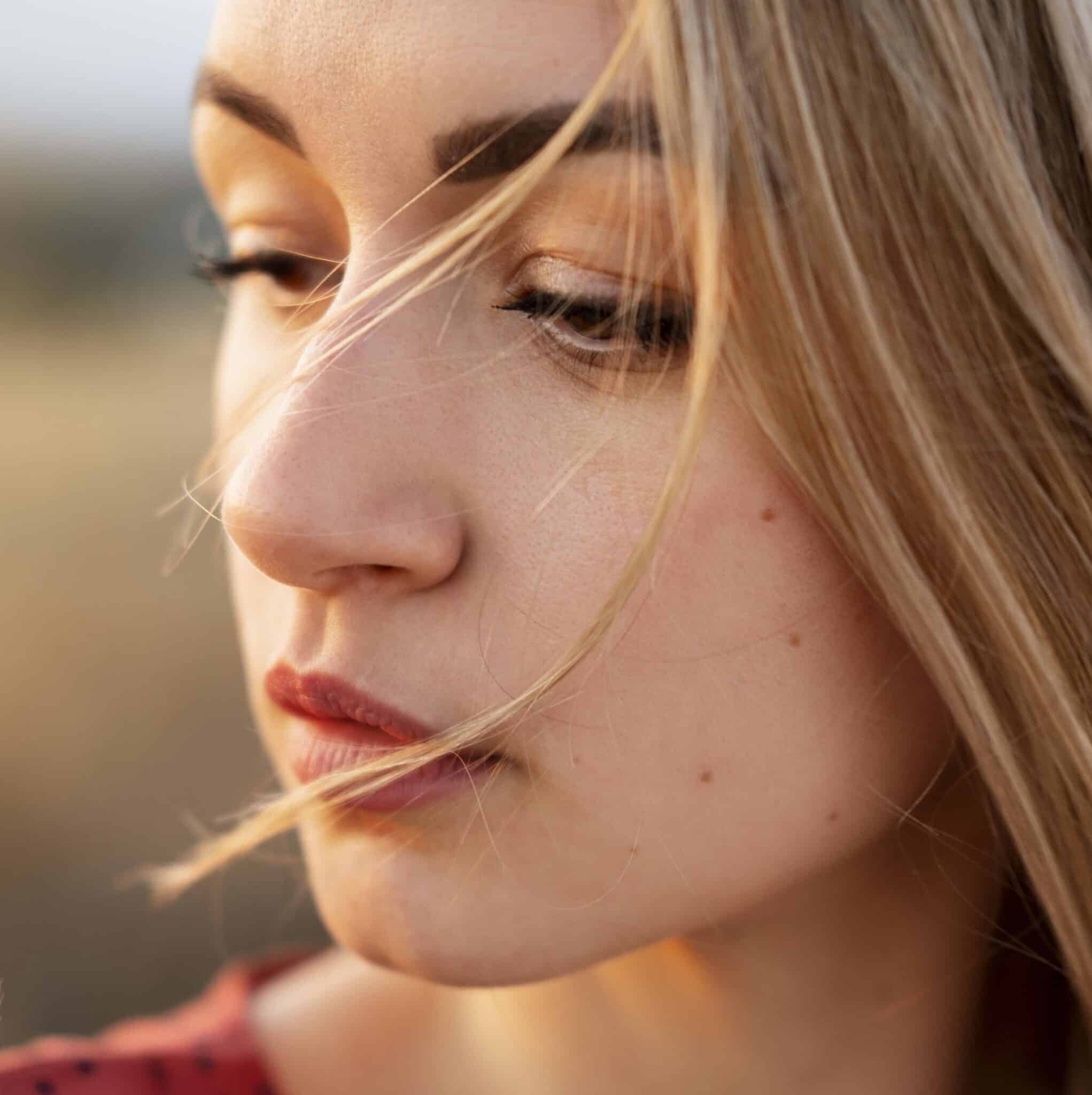 rougeur-rosacee-couperose-confidence-clinique-esthetique-lille-marcq-en-baroeul-1