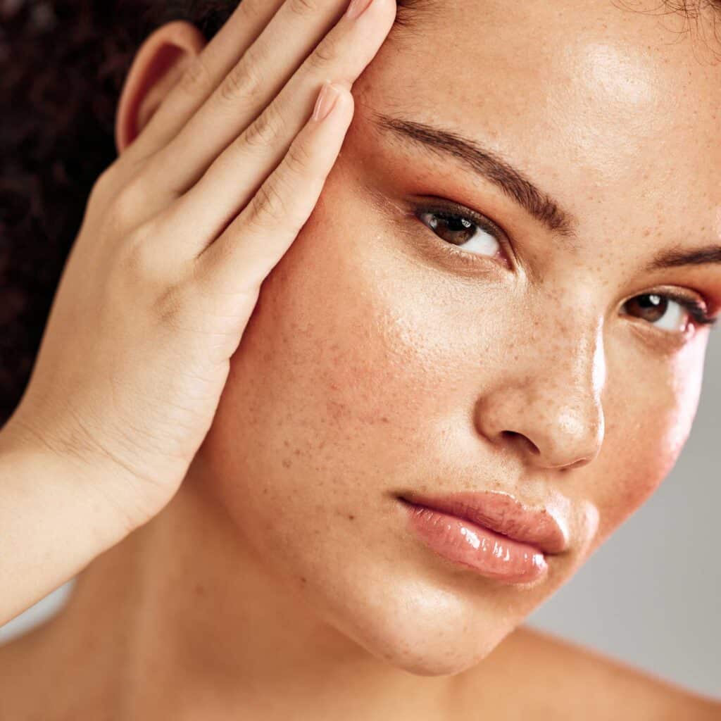 tache-pigmentaire-soleil-vieillesse-traitement-seance-laser-confidence-clinique-esthetique-lille-marcq-en-baroeul-6