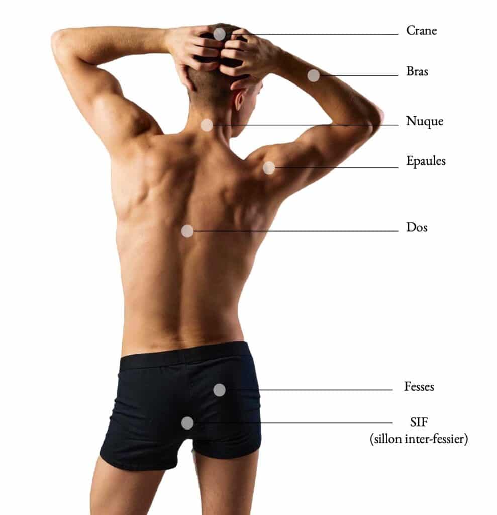 Epilation-laser-definitive-homme-maillot-torse-dos-epaules-barbe-nuque-12