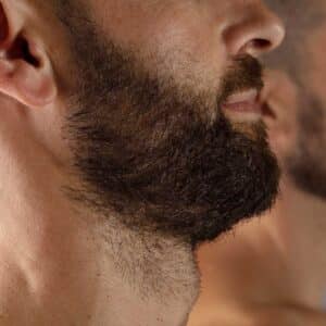 Epilation-laser-definitive-homme-aisselles-maillot-torse-dos-epaules-barbe-nuque-17