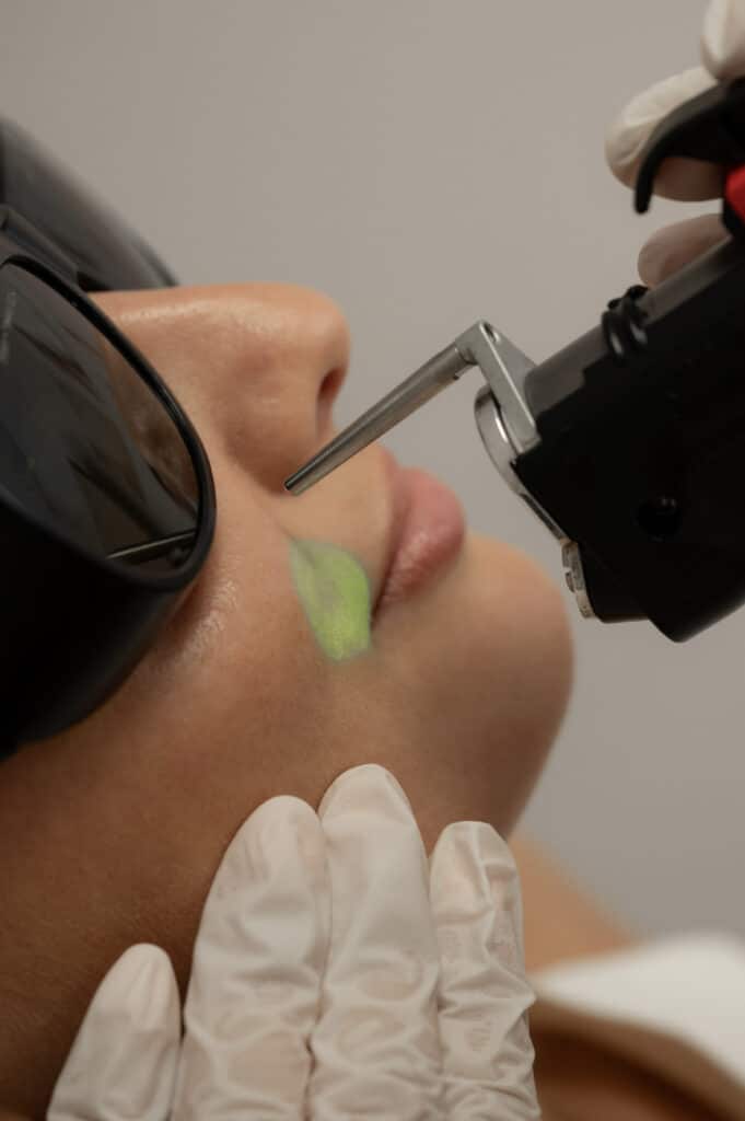 epilation-laser-remboursee-assurance-maladie-cpam-securite-sociale-hirsutisme-pilosite-excessive-10