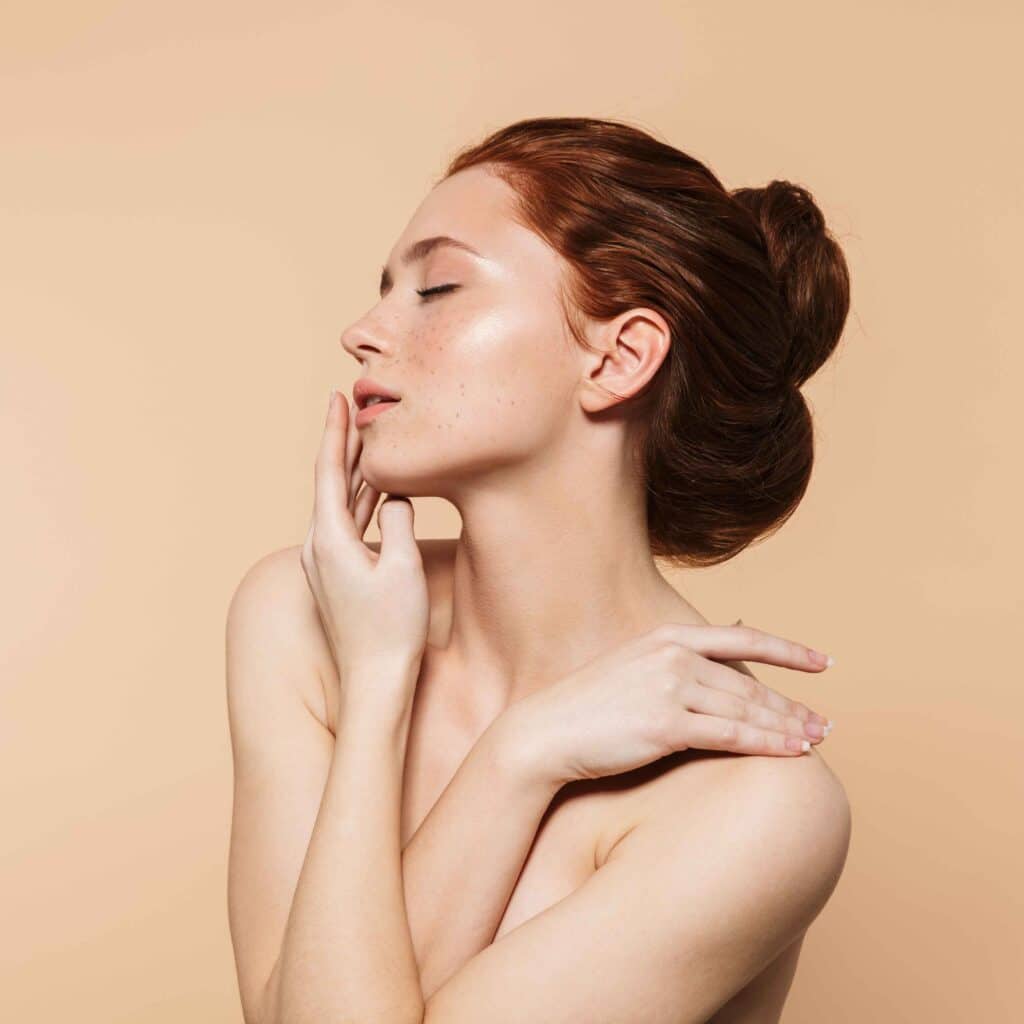 acne-traitement-kleresca-cicatrice-severe-peau-visage-clinique-confidence-marcq-lille-7