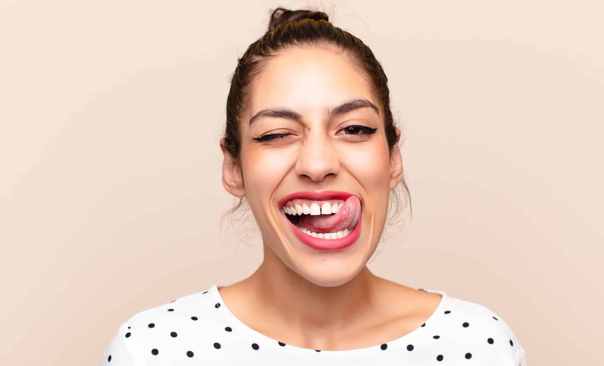sourire-gingival-botox-acide-hyaluronique-gencive-toxine-botulique-clinique-confidence-lille-marcq-en-baroeul-19
