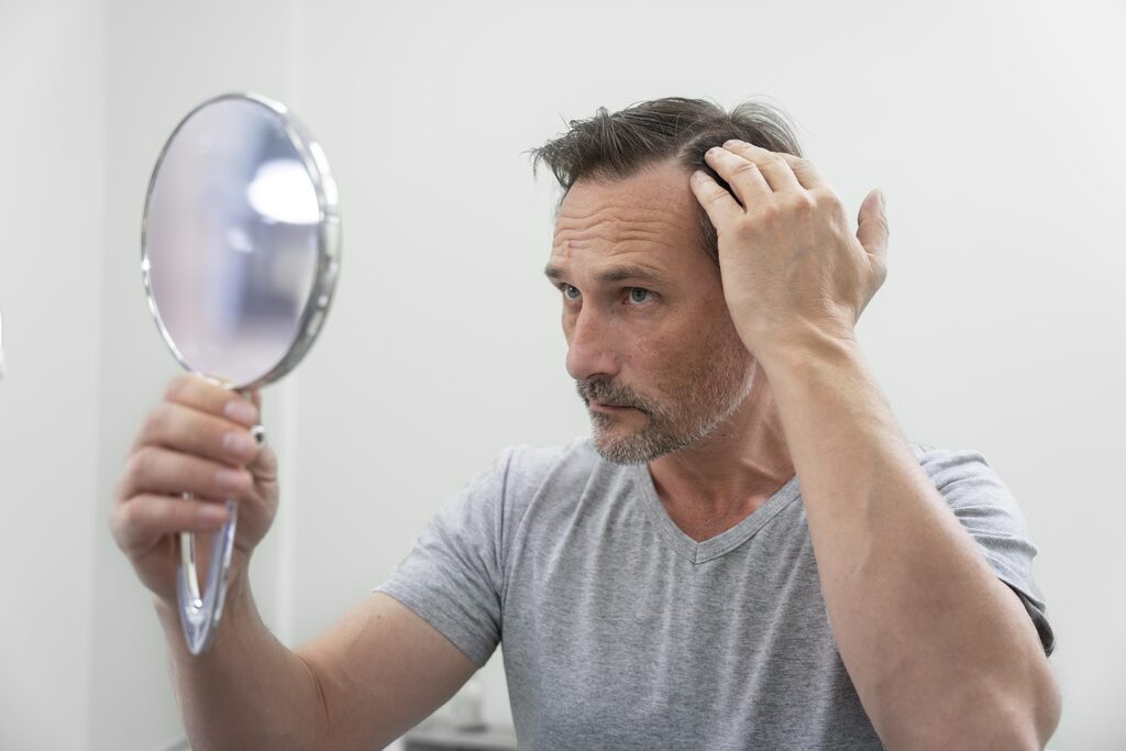 prp-mesotherapie-clinique-confidence-lille-traitement-les-differences-traitement-avant-apres-chute-de-cheveux-005