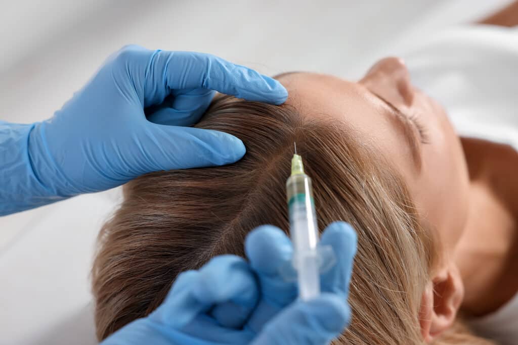 prp-mesotherapie-clinique-confidence-lille-traitement-les-differences-traitement-avant-apres-chute-de-cheveux-004