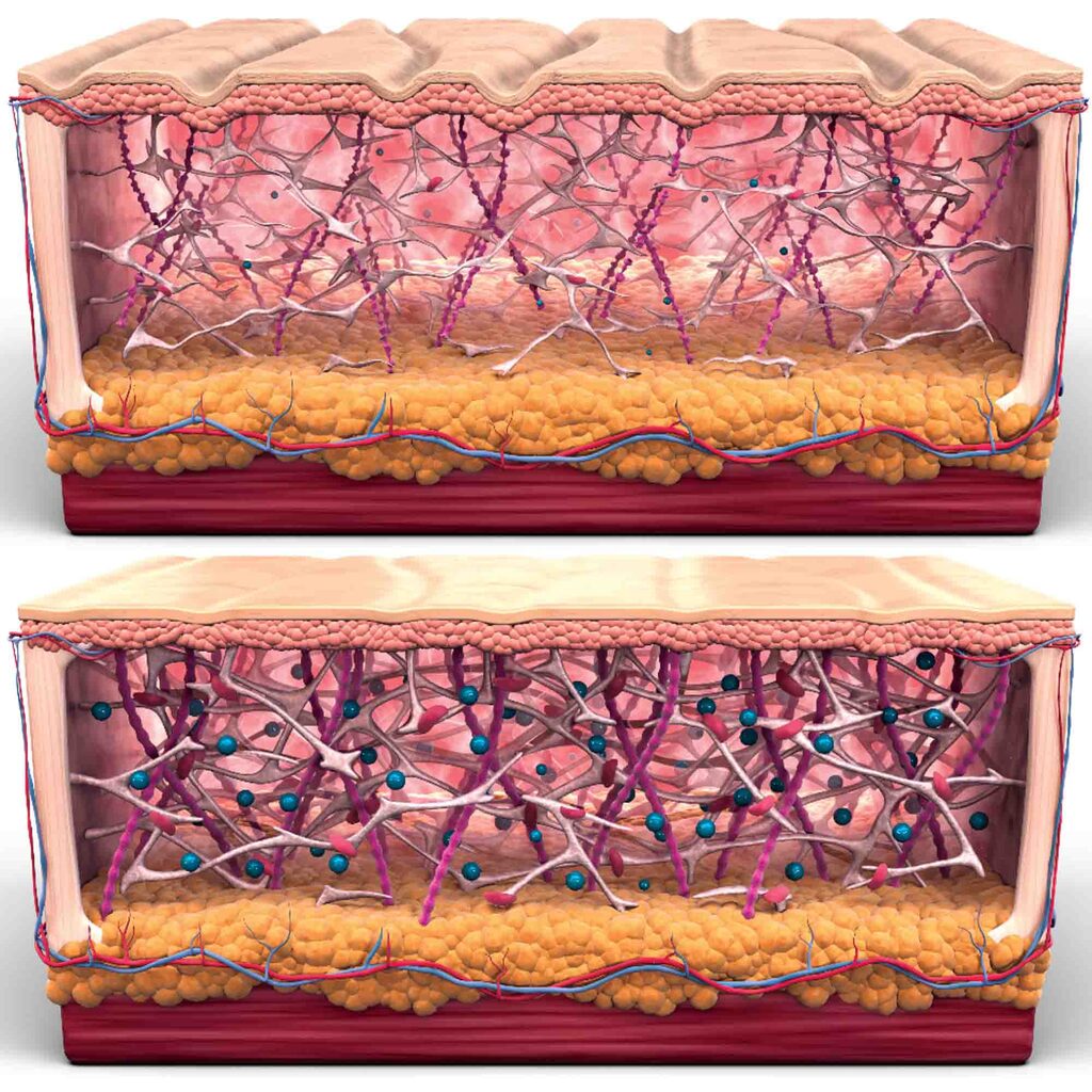 sofwave-collagene-lifting-cou-visage-eyeborw-resultat-avant-apres-prix-tarif-clinique-confidence-lille-001
