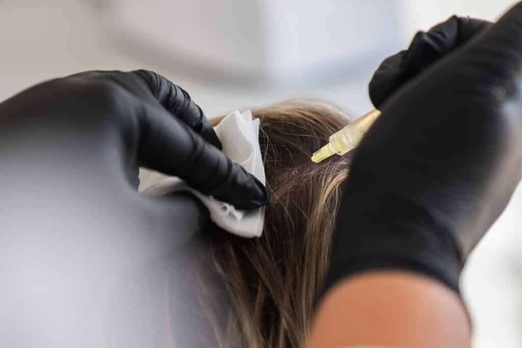 mesotherapie-capillaire-clinique-confidence-lille-traitement-vitamines-composition-chute-cheveux-vitmaines-acide-hyaluronique-7