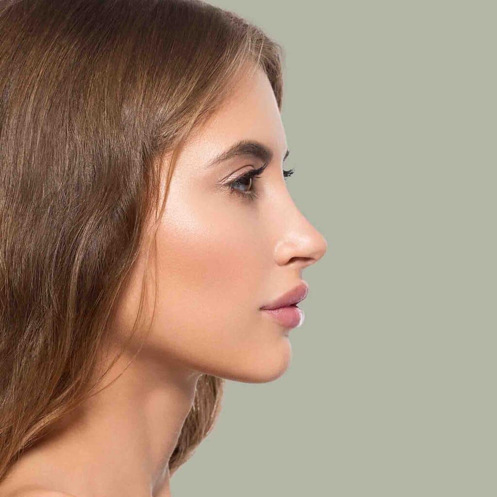 rhinoplastie-medicale-lille-acide-hyaluronique-sans-chirurgie-avant-apres-resultat-prix-tarif-nez-bosse-docteur-branczko-clinique-confidence-005