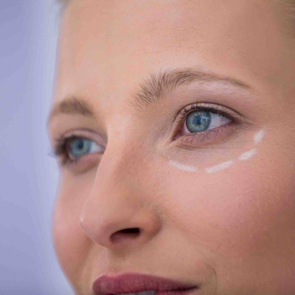 cernes-proche-creux-yeux-bleu-violet-traitement-comment-attenuer-solution-resultat-avant-apres-avis-005