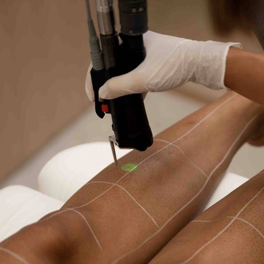 epilation-laser-lille-prix-resultat-avant-apres-avis-clinique-confidence-dr-natalia-branczko-001