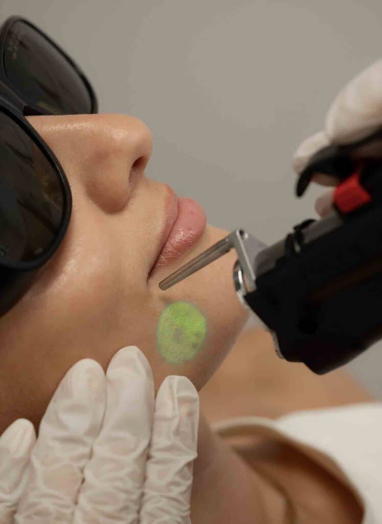 epilation laser-definitive-sopk-resultat-avant-apres-prix-tarifs-remboursement-mutuelle