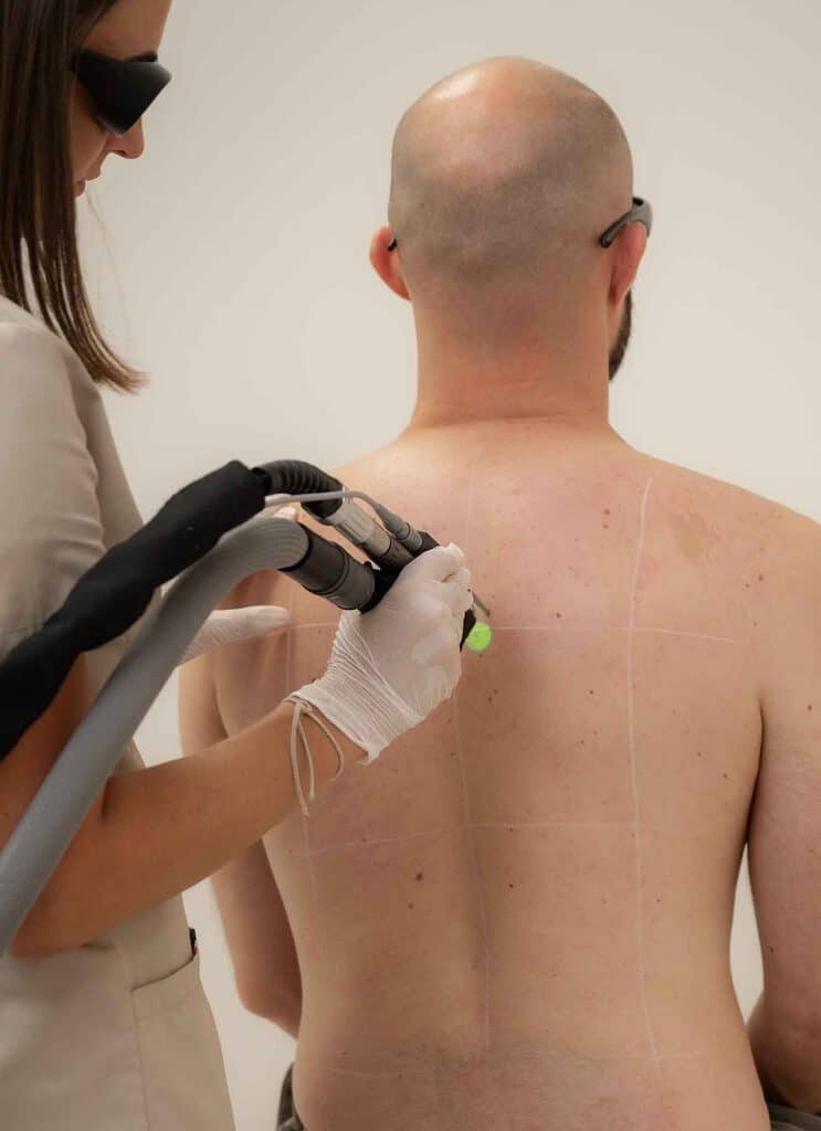epilation-laser-homme-definitive-dos-epaule-barbe-testicules-parties-intimes-clinique-confidence-centre-laser-medical-clarity