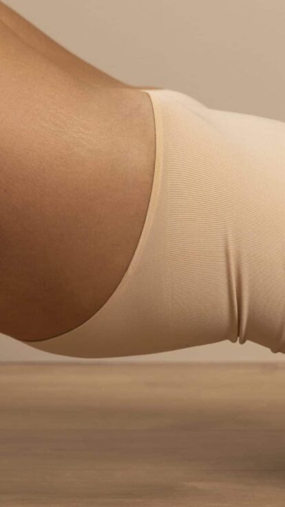 Microneedling Radiofréquence